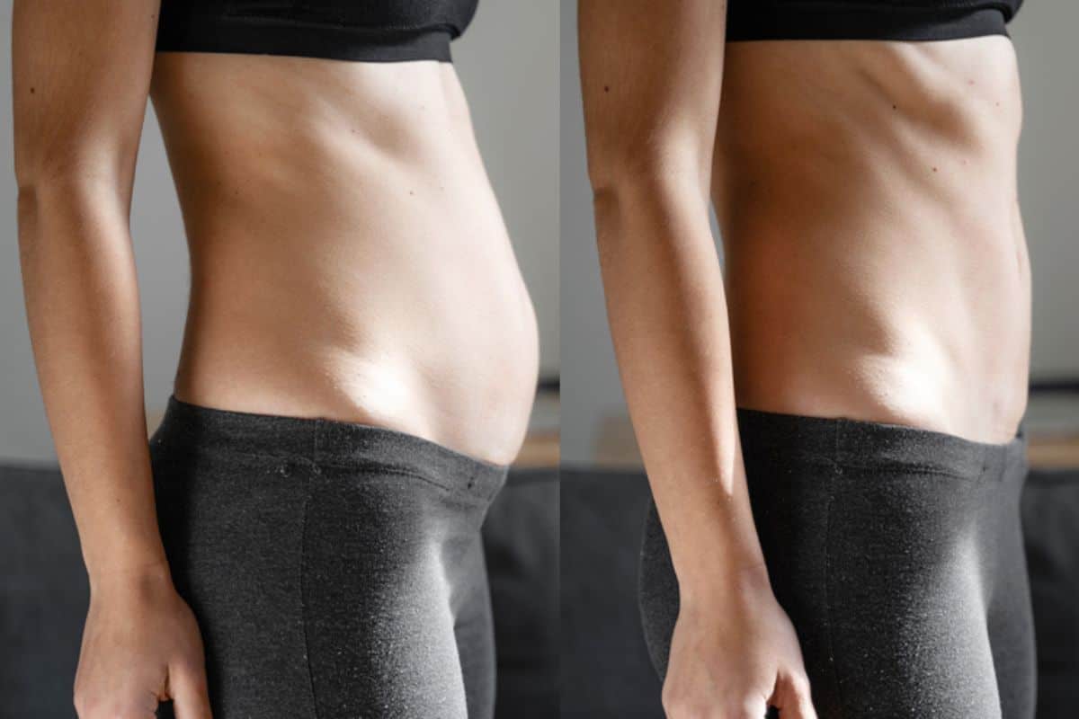 Post-Pregnancy: What Happens to Your Abdominal Muscles After Birth Sedgley