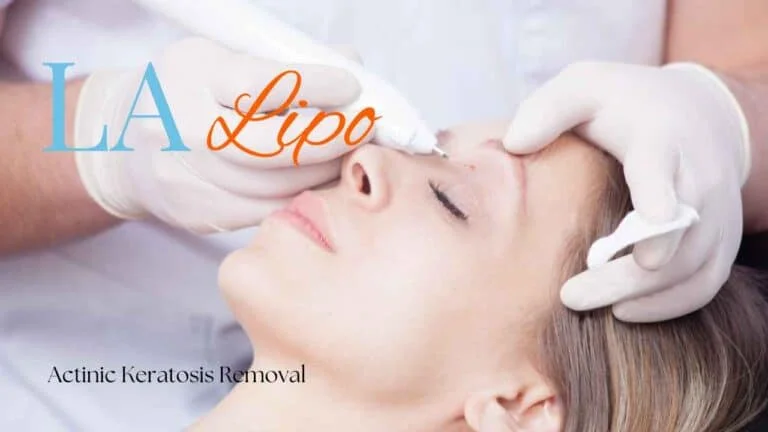 Woman receiving Actinic Keratosis Removal Treatment Sedgley