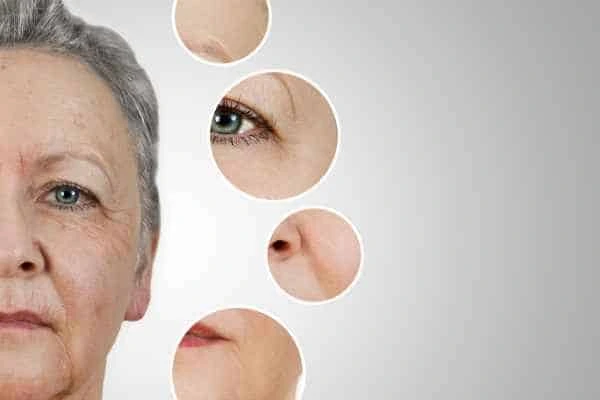 HIFU Facelift Sedgley from LA LIPO