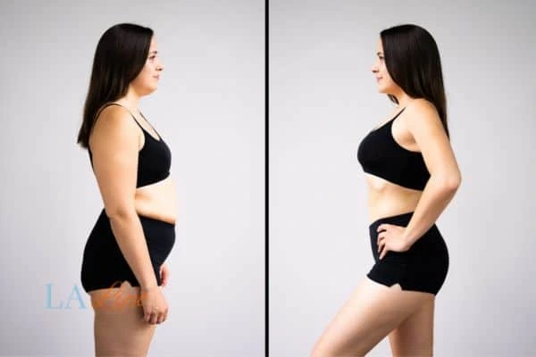 Picture of womans before and after using LA-EMS body sculpting to improve her core strength Sedgley