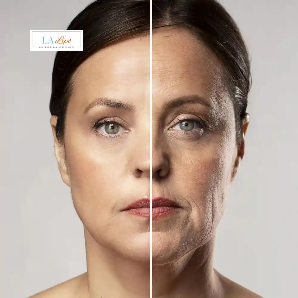 How Can You Tell If Non-Surgical Skin Tightening Is Right for You Sedgley?