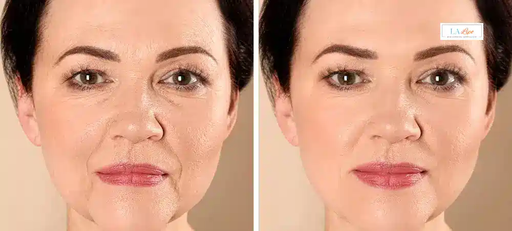 How Long Does It Take to See Results and How Long Do They Last Sedgley?