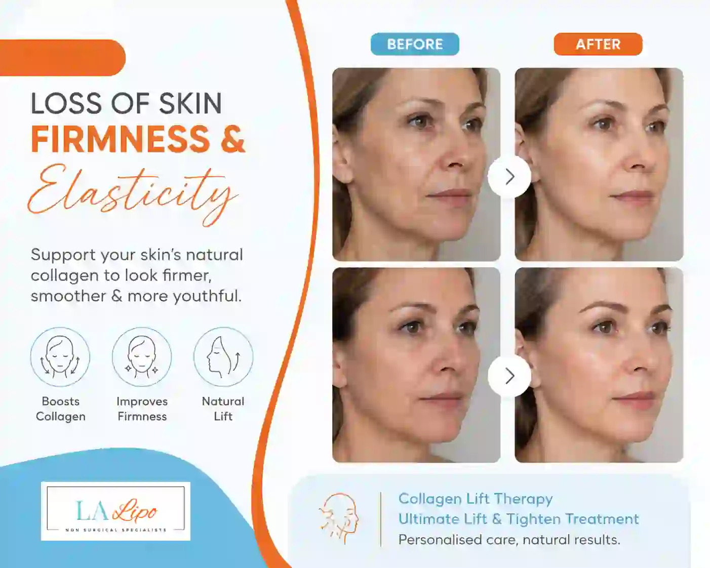 Sign #7: Loss of Skin Firmness and Elasticity Sedgley